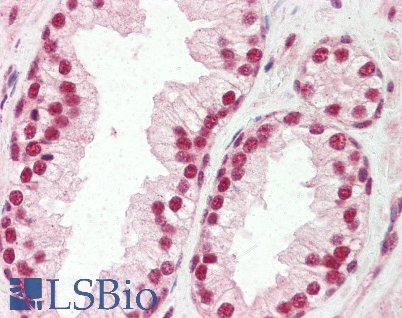 SNRPA / U1A Antibody (aa191-240)