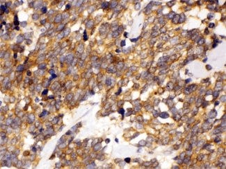 Polyclonal Rabbit anti-Human DDAH2 Antibody (IHC, WB)