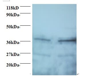 IHC-plus™ SCAMP3 Antibody (aa2-170)