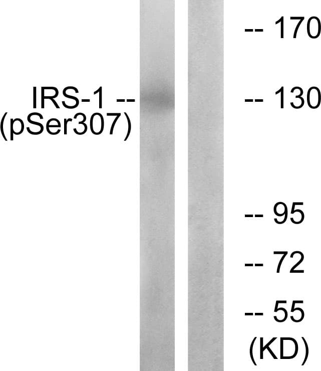 IRS1 Antibody (phospho-Ser307)