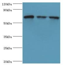 Polyclonal Rabbit anti-Human HSPA2 Antibody (aa400-639, IHC, WB)