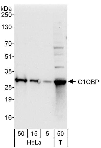 Polyclonal Rabbit anti-Human GC1qR / C1QBP Antibody (aa50-100, IHC, WB)