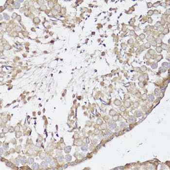 OPRK1 / Kappa Opioid Receptor Antibody