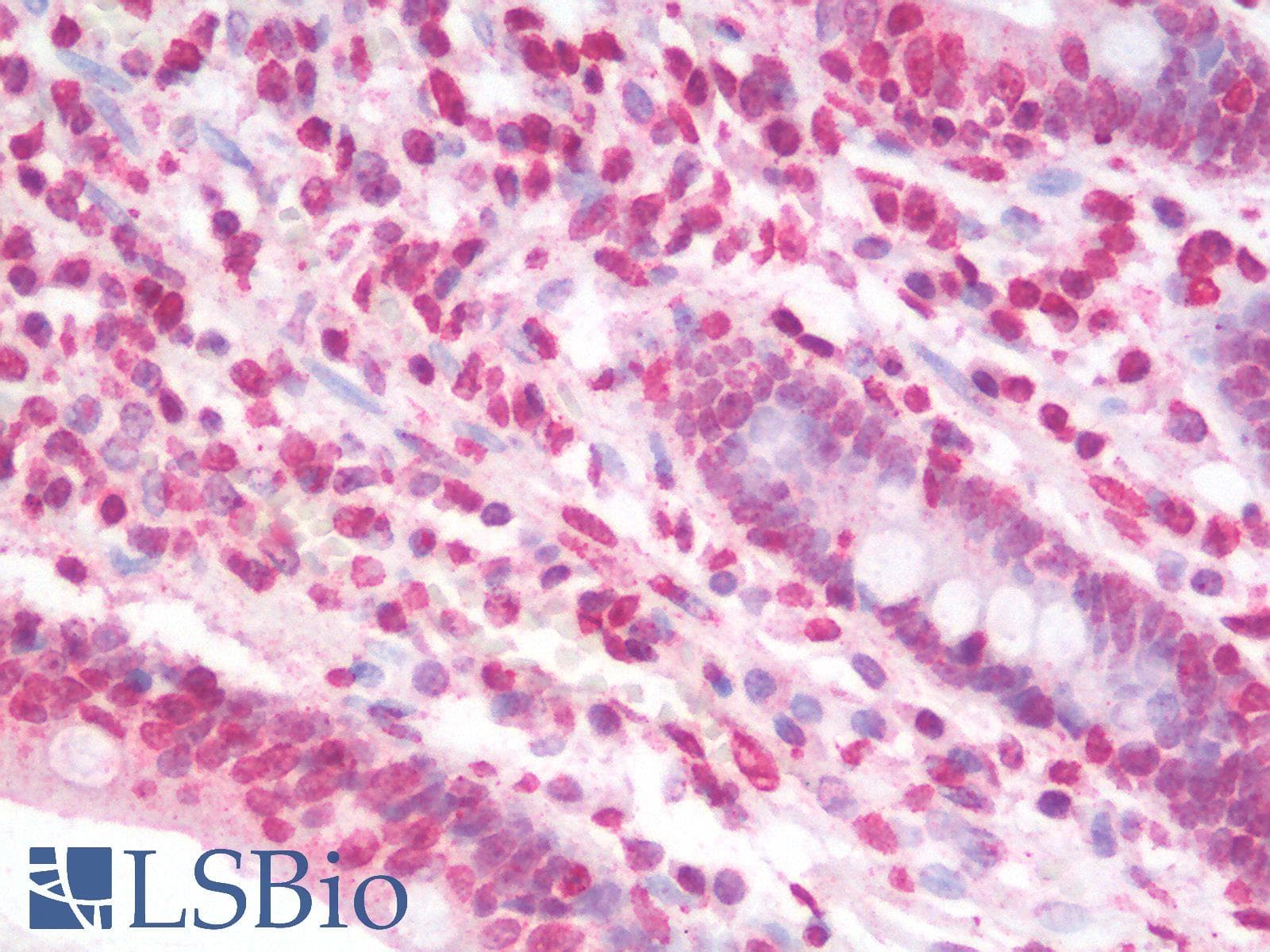 IHC-plus™ GNL3 / NS / Nucleostemin Antibody (aa115-126)