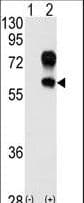Polyclonal Rabbit anti-Human KREMEN1 / KREMEN-1 Antibody (aa6-37, IHC, WB)