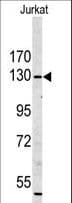 MYO1A Antibody (aa276-304)