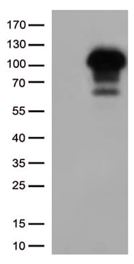 SIRT1 / Sirtuin 1 Antibody (aa552-676, clone OTI5B2)