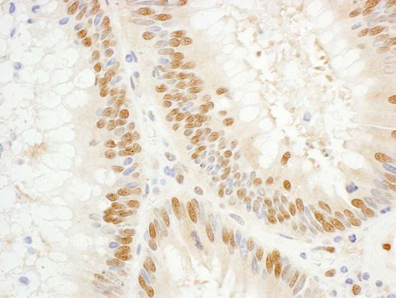 GTF2E1 Antibody (aa100-150)