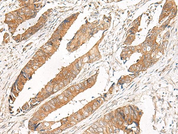 GBP4 / Mpa2 Antibody