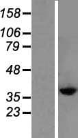 CYSLT2 / CYSLTR2 Protein (Over-Expression Lysate Myc-DDK (Flag))
