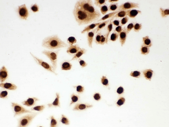 Polyclonal Rabbit anti-Human DDB1 Antibody (IHC, WB)