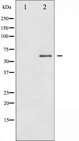 Polyclonal Rabbit anti-Human SMAD2 Antibody (phospho-Ser250, IF, WB)