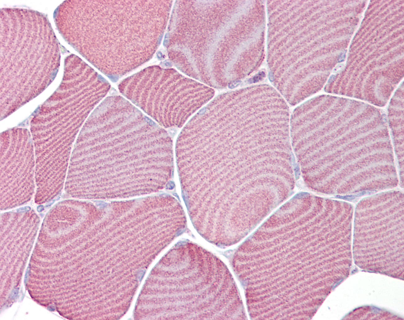 PathPlus™ Polyclonal Rabbit anti-Human FABP3 / H-FABP Antibody (aa36-85, IHC, WB)