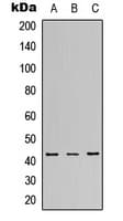 Polyclonal Rabbit anti-Human MAPK14 / p38 Antibody (Internal, IHC, WB)