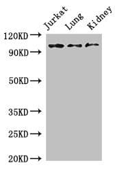 Polyclonal Rabbit anti-Human SMARCAL1 Antibody (IF, WB)