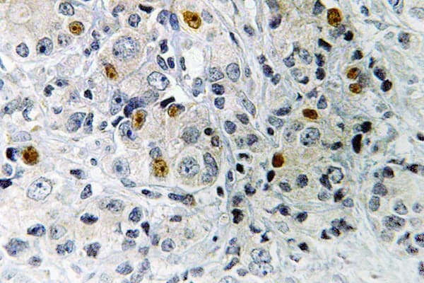 FRA-1 / FOSL1 Antibody (Asp134)