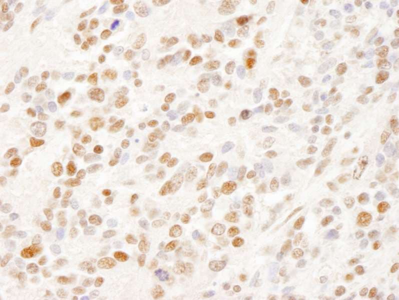 SUGP2 / SFRS14 Antibody (aa725-775)