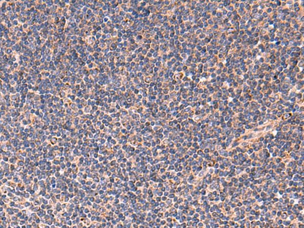 TNF Alpha Antibody
