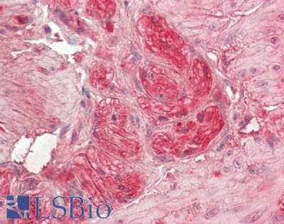 IHC-plus™ MEK1 + MEK2 Antibody