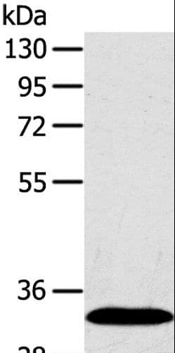 SULT2A1 / Sulfotransferase 2A1 Antibody