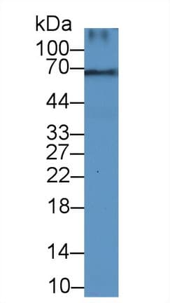 DCN / Decorin Antibody (aa45-152)