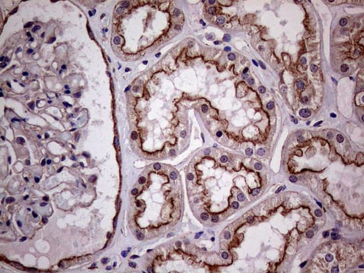 CLTA / LCA Antibody (clone OTI2C2)