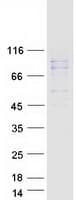 Human DHX35 Protein (Recombinant Myc-DDK (Flag))