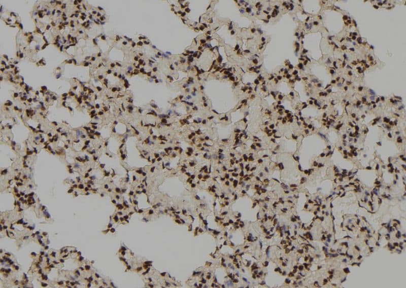 RFC3 Antibody