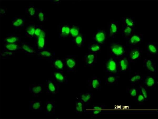 IHC-plus™ SIRT1 / Sirtuin 1 Antibody (clone 7B7)