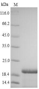 Hepatitis B Virus SARS-CoV Spike Glycoprotein (Recombinant 6His, N-terminus)