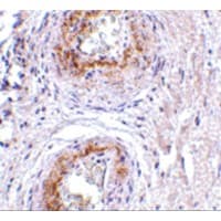 Polyclonal Rabbit anti-Human ADGRA2 / GPR124 Antibody (IHC, WB)