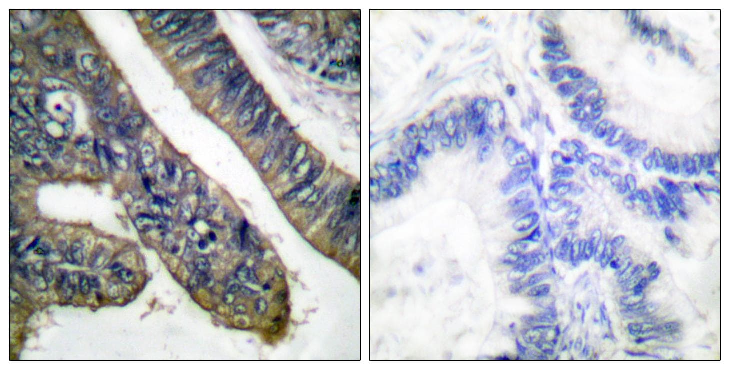 PLA2G4A Antibody (phospho-Ser505)