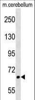AKAP8L Antibody (aa485-512)