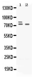 ZBTB16 / PLZF Antibody