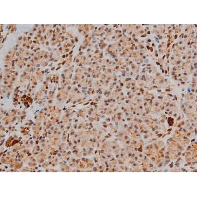 CREB1 / CREB Antibody (phospho-Ser133)