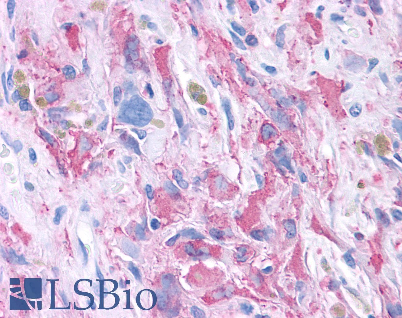PathPlus™ PKD3 / PRKD3 Antibody (Internal)