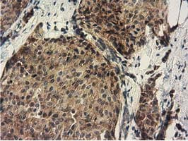 DNAJA2 Antibody (clone OTI3H10)