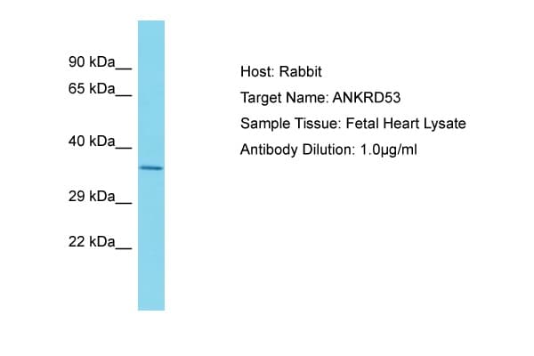 Polyclonal Rabbit anti-Human ANKRD53 Antibody (aa79-128, WB)