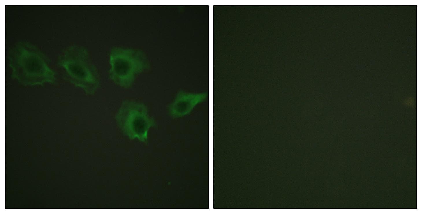 PPP1R12A / MYPT1 Antibody (phospho-Thr696)