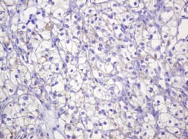 CTNND1 / p120 Catenin Antibody (clone OTI2E8)