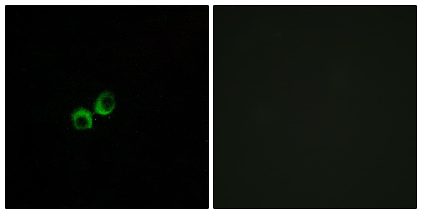 T1R3 / TAS1R3 Antibody (aa326-375)