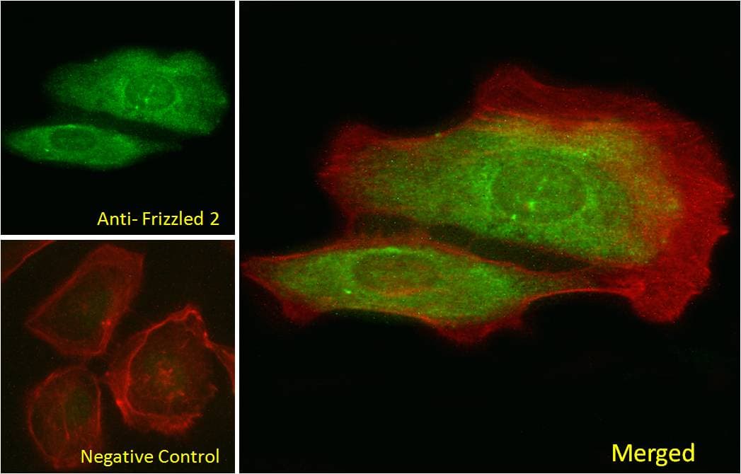 IHC-plus™ FZD2 / Frizzled 2 Antibody (aa267-279)