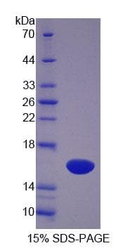 Human SCP2 / SCPX Protein (Recombinant His-T7, N-terminus)