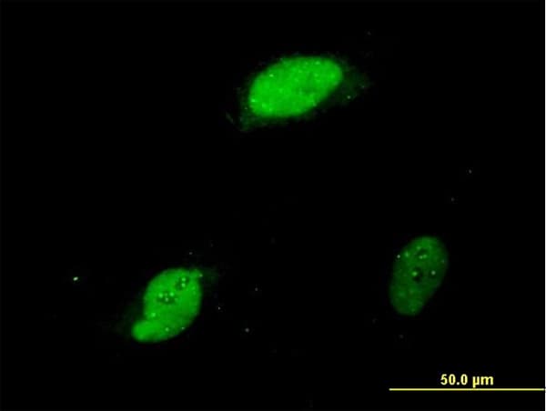 Monoclonal Mouse anti-Human ZIF268 / EGR1 Antibody (clone 6E8, IF, WB)