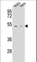 CPB / Carboxypeptidase B Antibody (aa9-37)
