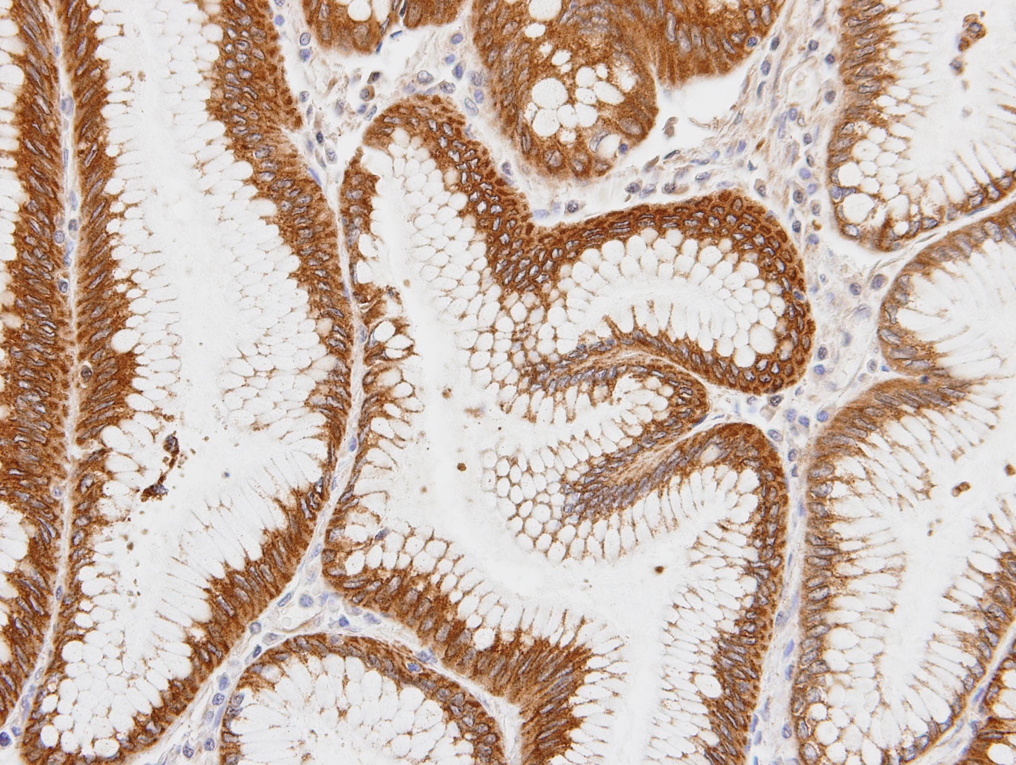 ADAP1 / CENTA1 Antibody (aa312-374)