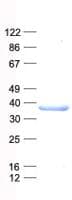 Human C21orf91 Protein (Recombinant His, N-Terminal)