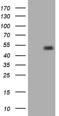 RORB / ROR Beta Antibody (aa1-260, clone OTI4B12)