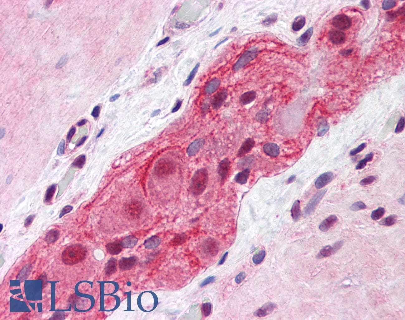 IHC-plus™ MED17 / TRAP80 Antibody (clone 4D4)