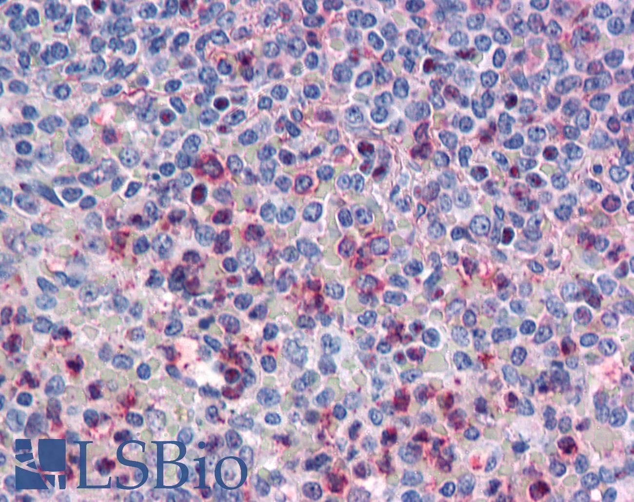 IHC-plus™ ATP1B3 Antibody (Internal)